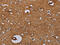 Interleukin-27 receptor subunit alpha antibody, CSB-PA953889, Cusabio, Immunohistochemistry paraffin image 