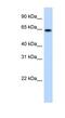 Ring Finger Protein 6 antibody, NBP1-80251, Novus Biologicals, Western Blot image 