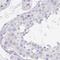 Pancreatic adenocarcinoma upregulated factor antibody, NBP2-49089, Novus Biologicals, Immunohistochemistry paraffin image 