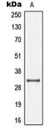 Connexin-32 antibody, orb213979, Biorbyt, Western Blot image 