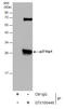 Cyclin Dependent Kinase Inhibitor 1B antibody, GTX100446, GeneTex, Immunoprecipitation image 