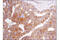 PVR Cell Adhesion Molecule antibody, 81254S, Cell Signaling Technology, Immunohistochemistry paraffin image 