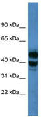 Cytochrome P450 Family 21 Subfamily A Member 2 antibody, TA342859, Origene, Western Blot image 