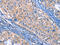 Integrin Subunit Beta 3 antibody, CSB-PA089157, Cusabio, Immunohistochemistry frozen image 