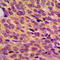 Neurofibromin 1 antibody, LS-C352564, Lifespan Biosciences, Immunohistochemistry paraffin image 