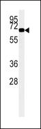 Acyl-CoA Oxidase 1 antibody, LS-B11320, Lifespan Biosciences, Western Blot image 