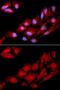 Catenin Delta 1 antibody, GTX33378, GeneTex, Immunofluorescence image 