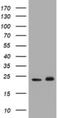 Glutathione S-transferase P 1 antibody, NBP2-45916, Novus Biologicals, Western Blot image 