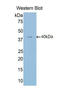 HIF-2-alpha antibody, LS-C294562, Lifespan Biosciences, Western Blot image 