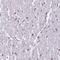 Karyopherin Subunit Alpha 3 antibody, NBP2-14172, Novus Biologicals, Immunohistochemistry frozen image 