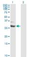 Cell Death Inducing DFFA Like Effector A antibody, H00001149-M01, Novus Biologicals, Western Blot image 
