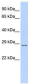 Tissue Factor Pathway Inhibitor 2 antibody, TA344403, Origene, Western Blot image 