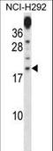 Proline Rich 15 antibody, LS-C162180, Lifespan Biosciences, Western Blot image 