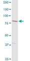 Adseverin antibody, H00085477-D01P, Novus Biologicals, Western Blot image 