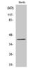 PR/SET Domain 12 antibody, STJ95217, St John