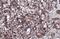 Cytochrome C Oxidase Subunit 4I1 antibody, NBP2-15975, Novus Biologicals, Immunohistochemistry paraffin image 