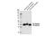 Sodium Voltage-Gated Channel Beta Subunit 2 antibody, 14686S, Cell Signaling Technology, Western Blot image 