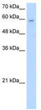 Ariadne RBR E3 Ubiquitin Protein Ligase 2 antibody, TA335693, Origene, Western Blot image 