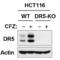 TNF Receptor Superfamily Member 10b antibody, A00410-2, Boster Biological Technology, Western Blot image 
