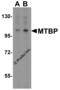 Mdm2-binding protein antibody, 2447, ProSci Inc, Western Blot image 