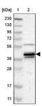 Mitogen-Activated Protein Kinase 13 antibody, PA5-52465, Invitrogen Antibodies, Western Blot image 