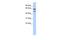 Eukaryotic Translation Initiation Factor 3 Subunit E antibody, PA5-43136, Invitrogen Antibodies, Western Blot image 