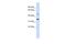 Zinc Finger Protein 398 antibody, A14014, Boster Biological Technology, Western Blot image 