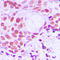 Tripartite Motif Containing 24 antibody, LS-C353100, Lifespan Biosciences, Immunohistochemistry paraffin image 