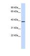 Glutaminyl-Peptide Cyclotransferase antibody, NBP1-79295, Novus Biologicals, Western Blot image 