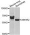 Anti-Mullerian Hormone Receptor Type 2 antibody, PA5-76011, Invitrogen Antibodies, Western Blot image 