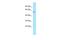 Adaptor Related Protein Complex 4 Subunit Mu 1 antibody, A09686, Boster Biological Technology, Western Blot image 