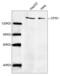 Carbamoyl-Phosphate Synthase 1 antibody, LS-B13688, Lifespan Biosciences, Western Blot image 