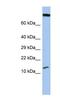 Uncharacterized protein FLJ37543 antibody, NBP1-79600, Novus Biologicals, Western Blot image 