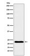 Troponin I1, Slow Skeletal Type antibody, M07080-1, Boster Biological Technology, Western Blot image 