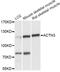 Actinin Alpha 3 (Gene/Pseudogene) antibody, LS-C747933, Lifespan Biosciences, Western Blot image 