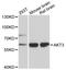 AKT Serine/Threonine Kinase 3 antibody, STJ114775, St John