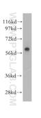 Poly(ADP-Ribose) Polymerase Family Member 3 antibody, 11289-1-AP, Proteintech Group, Western Blot image 