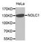 Nucleolar And Coiled-Body Phosphoprotein 1 antibody, orb373302, Biorbyt, Western Blot image 