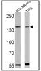 Erb-B2 Receptor Tyrosine Kinase 4 antibody, MA1-861, Invitrogen Antibodies, Western Blot image 