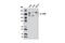 Interleukin 17 Receptor A antibody, 5503S, Cell Signaling Technology, Western Blot image 