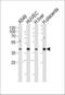 Oxidized Low Density Lipoprotein Receptor 1 antibody, GTX80987, GeneTex, Western Blot image 