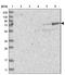 Adducin 2 antibody, NBP2-33974, Novus Biologicals, Western Blot image 