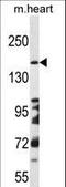 DCC Netrin 1 Receptor antibody, LS-C167288, Lifespan Biosciences, Western Blot image 