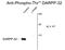 Protein Phosphatase 1 Regulatory Inhibitor Subunit 1B antibody, GTX82713, GeneTex, Western Blot image 