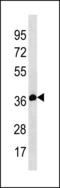 ETS Variant 7 antibody, LS-C203847, Lifespan Biosciences, Western Blot image 