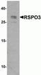 R-Spondin 3 antibody, NBP2-81849, Novus Biologicals, Western Blot image 