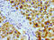 Alanine--Glyoxylate And Serine--Pyruvate Aminotransferase antibody, CSB-PA001468LA01HU, Cusabio, Immunohistochemistry paraffin image 