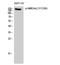 Glutamate Ionotropic Receptor NMDA Type Subunit 2B antibody, STJ90969, St John