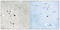 Fms Related Tyrosine Kinase 3 antibody, LS-C198966, Lifespan Biosciences, Immunohistochemistry frozen image 