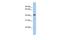 Stomatin Like 3 antibody, GTX45685, GeneTex, Western Blot image 